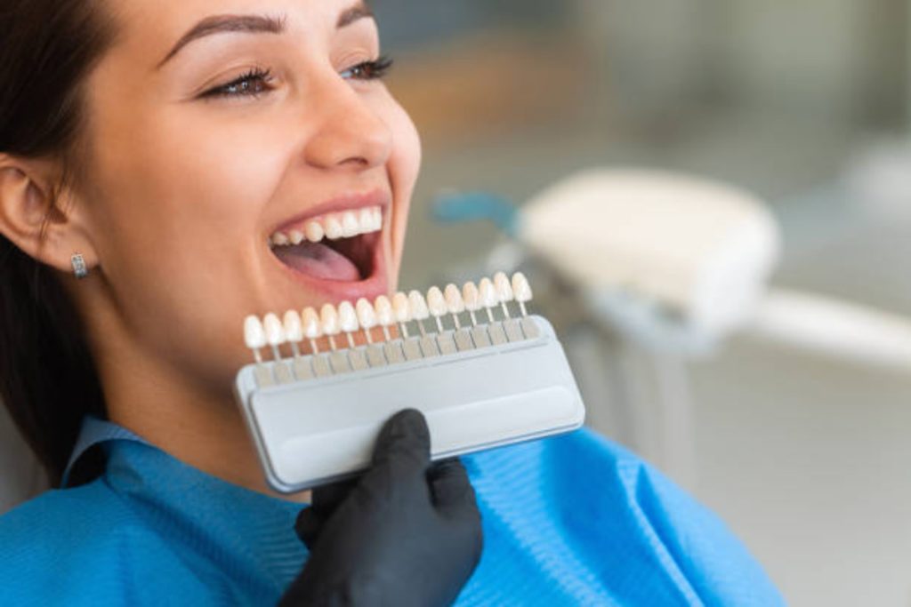 when veneers are the best option